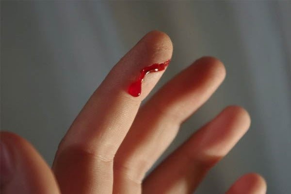Mơ thấy bị đứt tay có ý nghĩa gì?