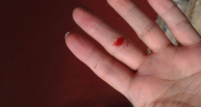 Giải mã giấc mơ thấy bị đứt tay