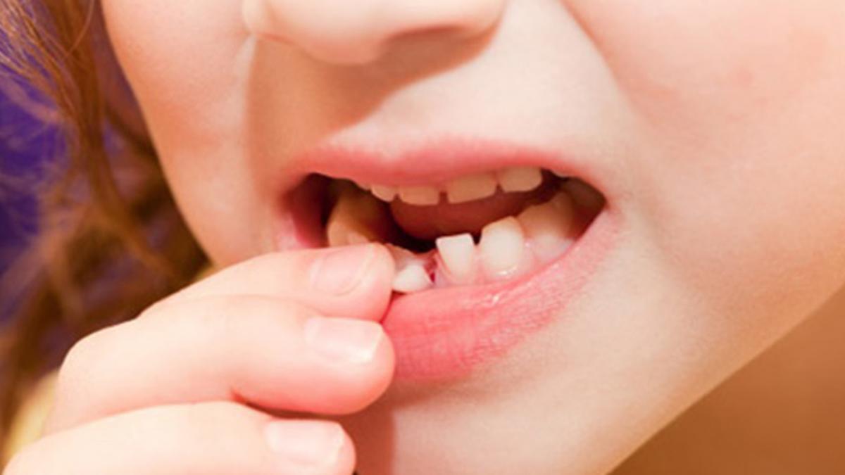 Nằm mơ thấy con răng đánh đề con gì?