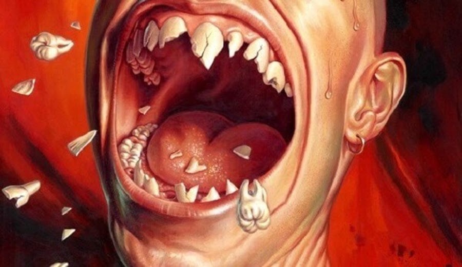 Ý nghĩa của giấc mơ thấy vỡ răng