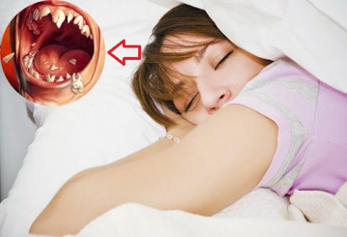 Giải mã giấc mơ thấy vỡ răng