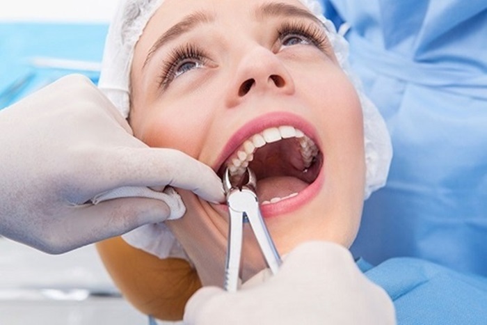 Ý nghĩa của giấc mơ thấy nhổ răng